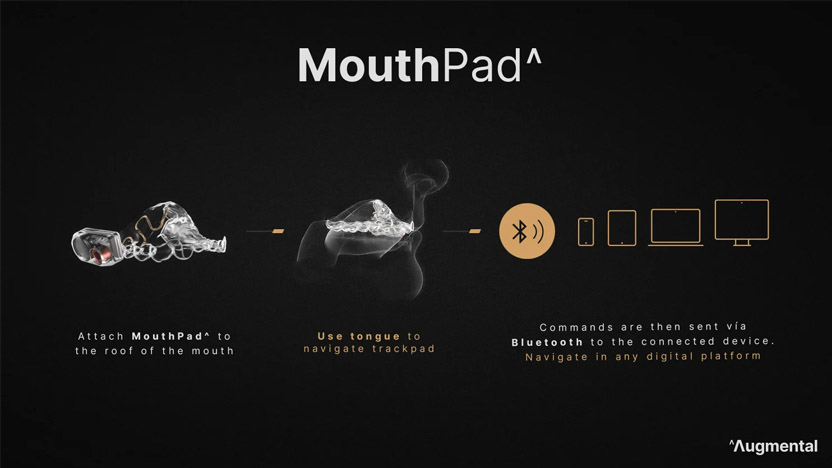MouthPad 3